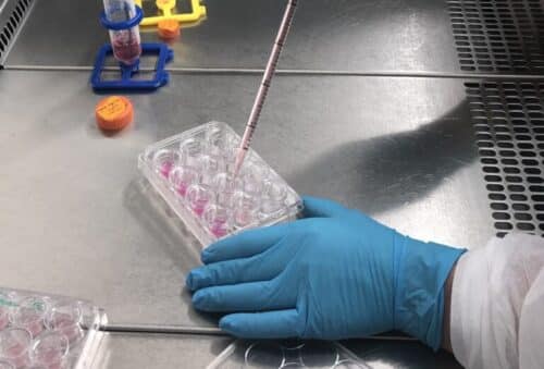 Explorer le cerveau pour mieux soigner : la mission innovante du LBHE