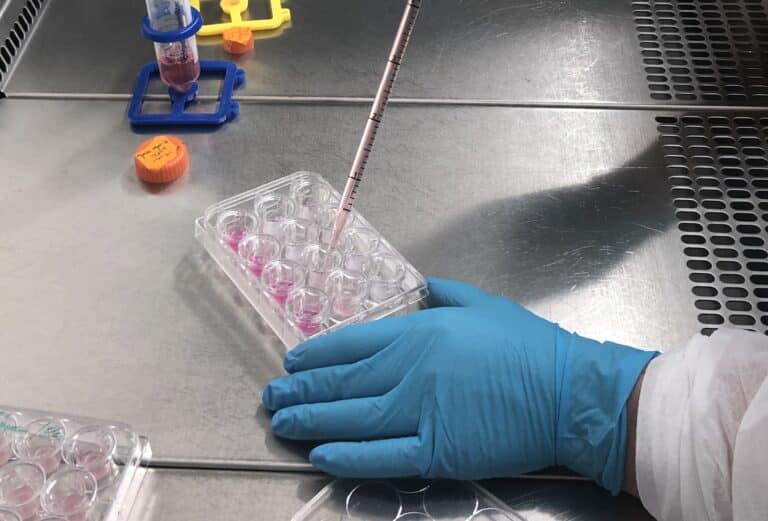 Explorer le cerveau pour mieux soigner : la mission innovante du LBHE
